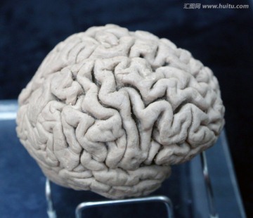 人体大脑标本