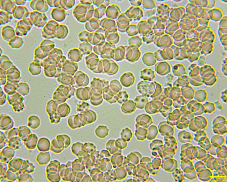 显微摄影 聚集的红细胞