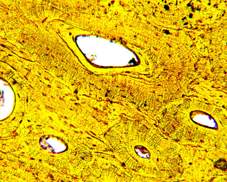 显微摄影 骨细胞
