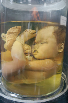 10个月胎儿标本