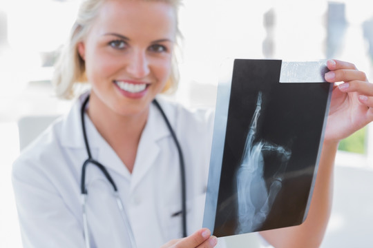 护士拿着一个X光片