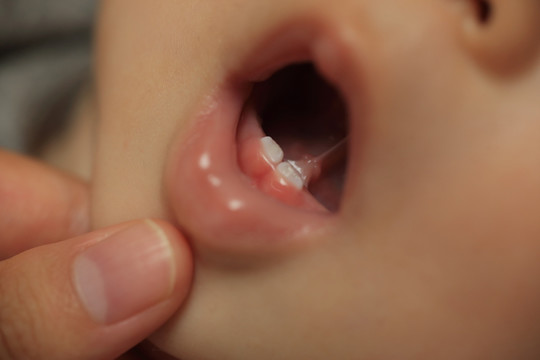 婴儿长牙齿过程