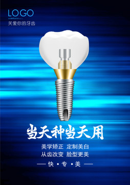 牙科廣告 牙科 種植牙