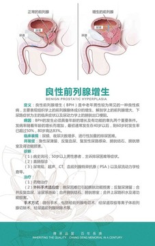 良性前列腺增生