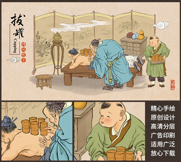 拔罐 火罐 傳統(tǒng)拔罐 中醫(yī)插畫