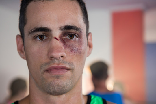 健身室男拳击手鼻子受伤特写