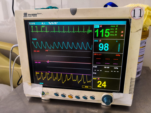 生命监测仪监护仪