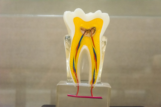 口腔病理模型牙神经