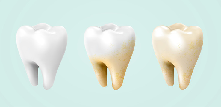 牙齿美白过程模型