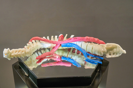 人体脊柱侧弯训练医疗模型