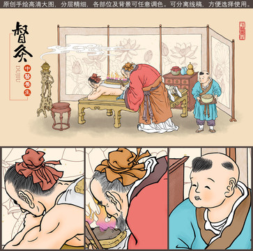 傳統(tǒng)中醫(yī)督灸插畫