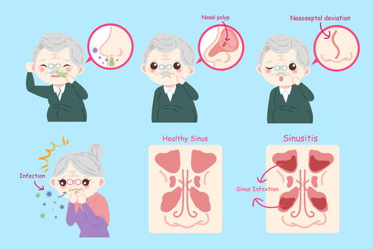 老年人鼻窦炎疾病素材集合