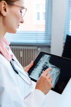 医生在她的现代平板电脑上查看肩膀的x光照片