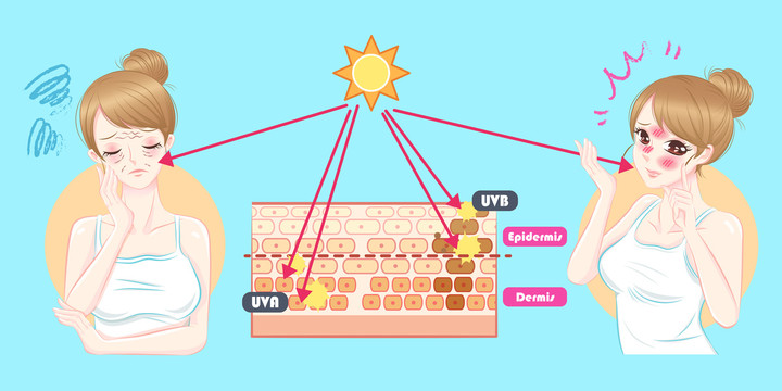 晒伤造成皮肤老化红肿插图