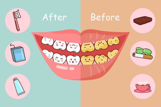 清洁饮食影响 牙齿颜色插图