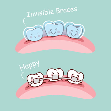 透明牙套把牙齿变整齐插图