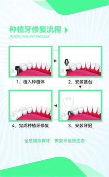 种植牙修复流程医院装修展板