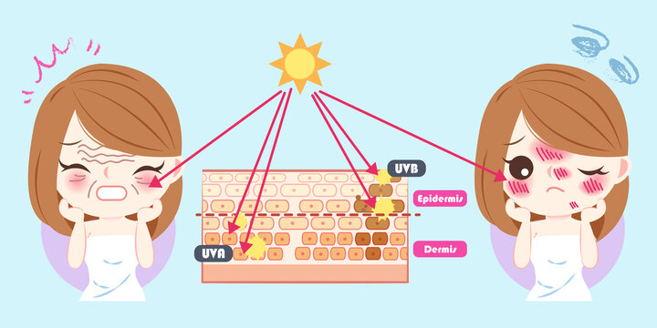 紫外线对女性肌肤的伤害插图
