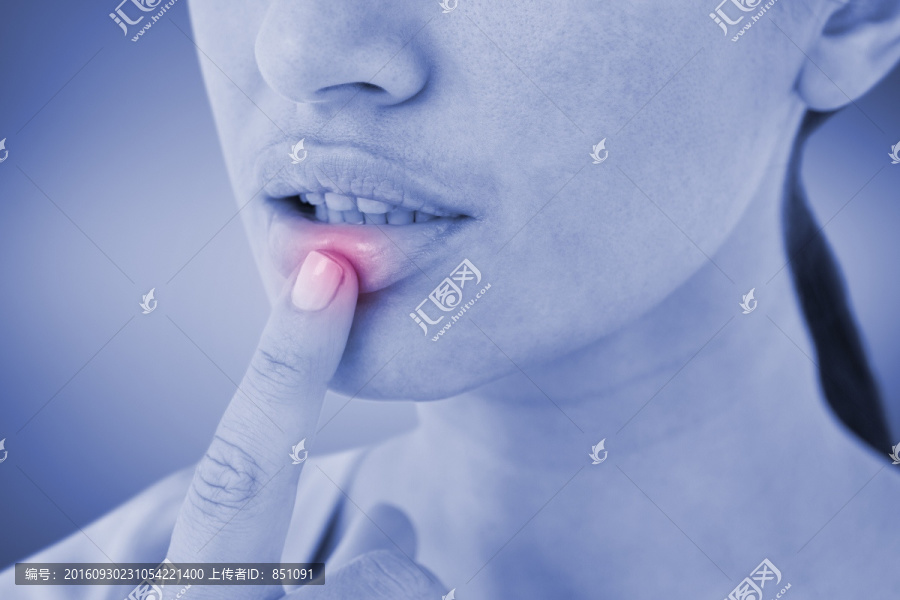 女人的嘴唇受傷了