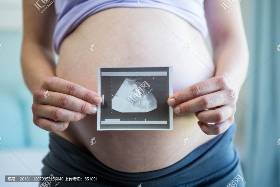 拿著照片的孕婦