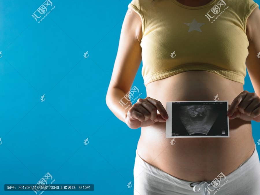 拿着超声照片的孕妇