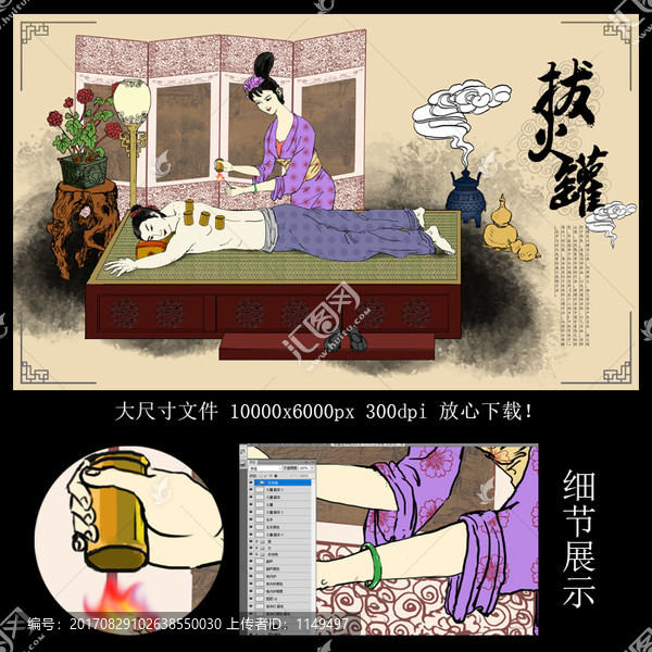 拔火罐,中醫(yī)養(yǎng)生拔罐