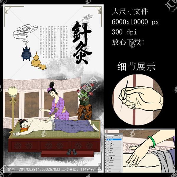 針灸,中醫(yī)針灸療法