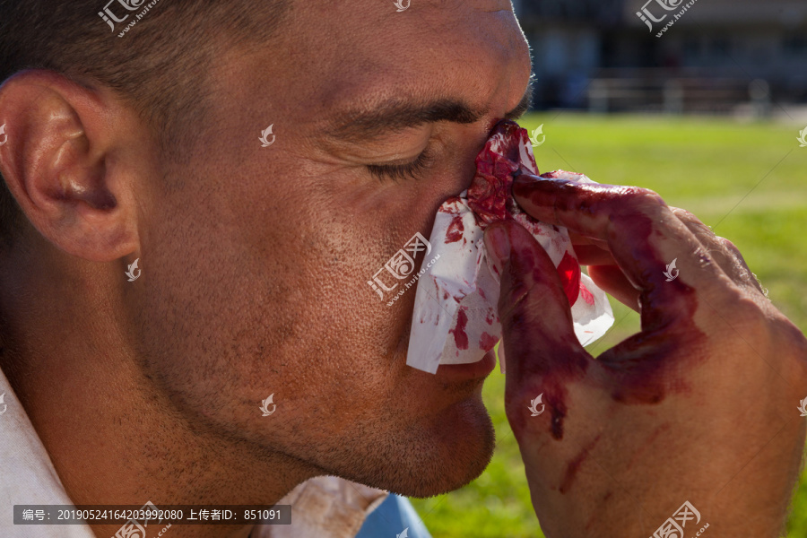 橄榄球运动员在比赛鼻子受伤