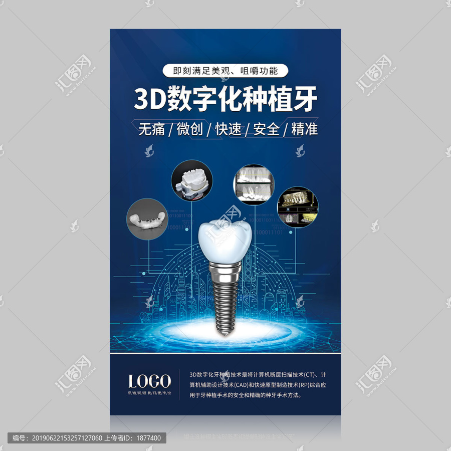 數(shù)字化種植牙3d