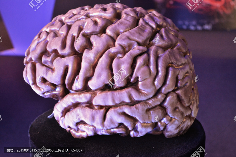 金属大脑模型