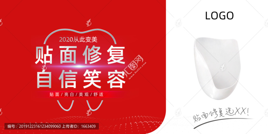貼面修復(fù)
