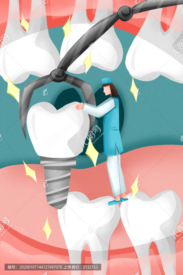 医生种植牙齿治疗牙齿插画