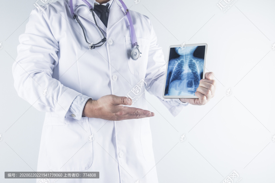 医生展示一个健康的肺部ct片