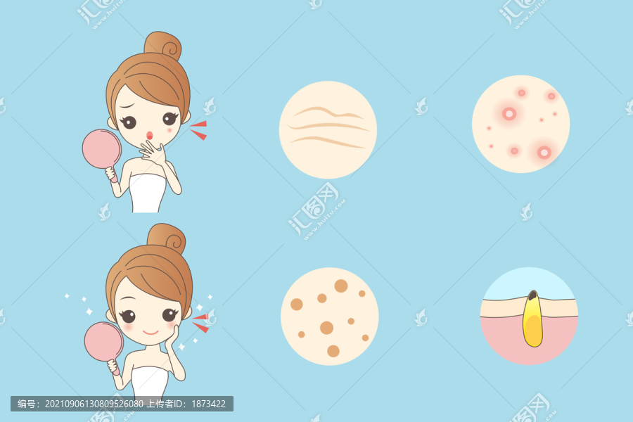 女人祛痤瘡卡通插圖