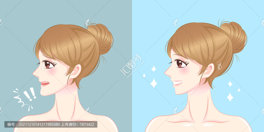 少女正顎手術(shù)對比插圖