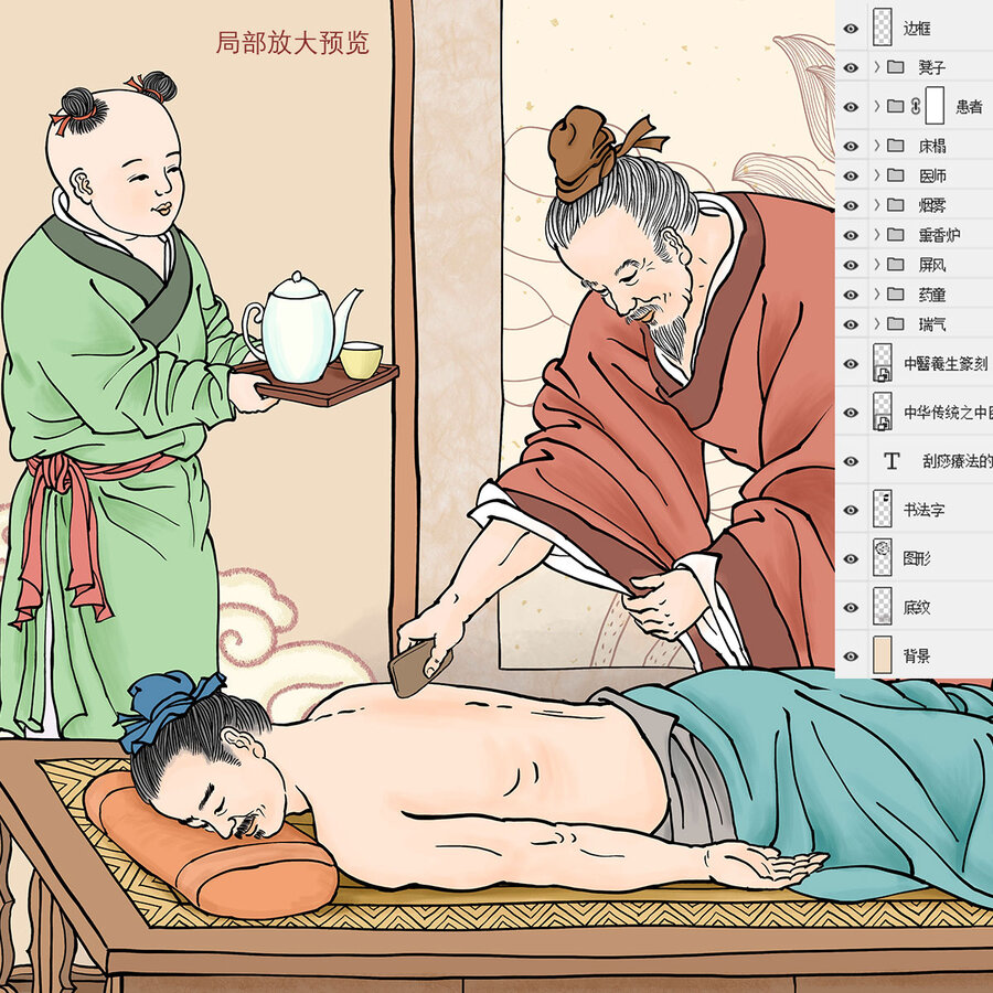 古代中醫(yī)刮痧插畫