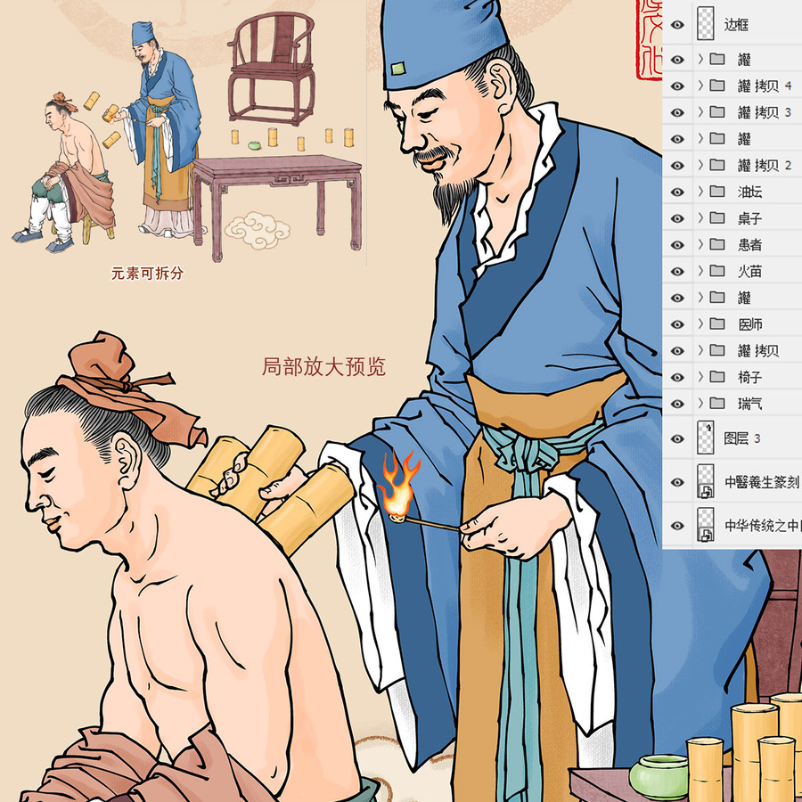 古代中医拔罐插画