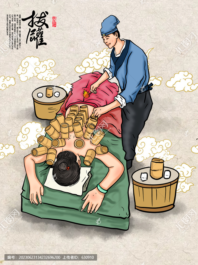 拔罐