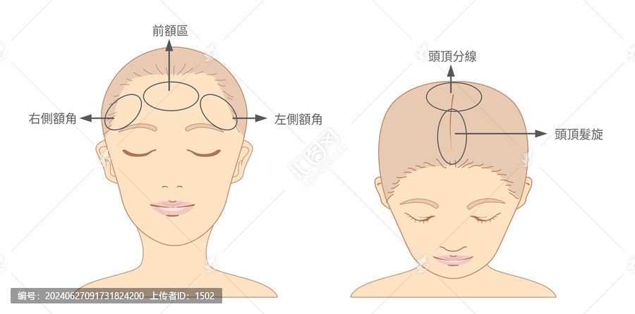 頭部分區(qū)