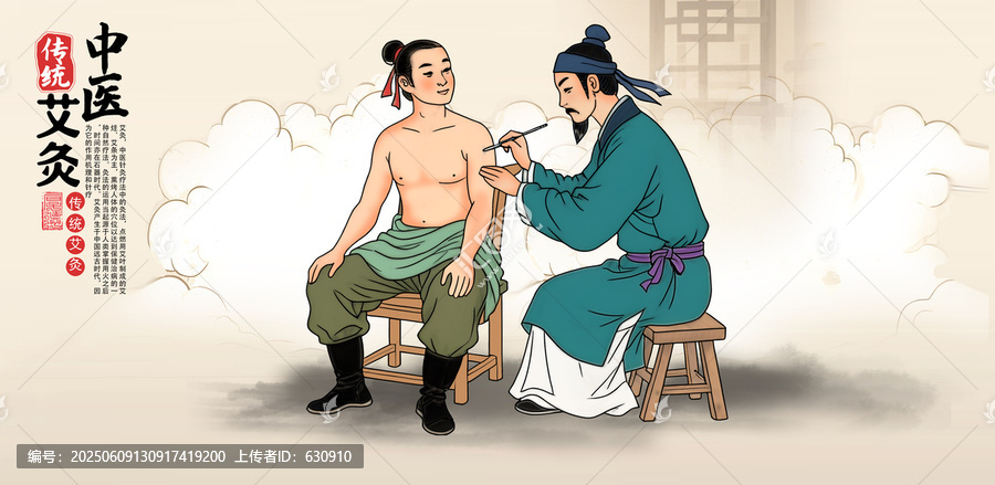 中醫(yī)針灸插畫(huà)