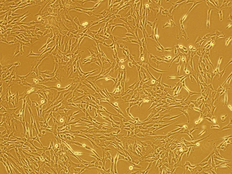 间充质干细胞P1传代电镜图