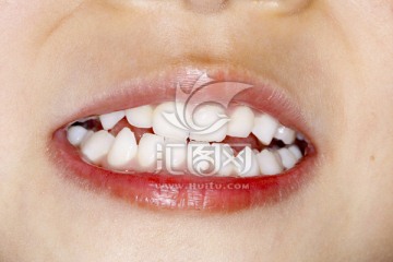 牙齿 爱护牙齿 清洁牙齿