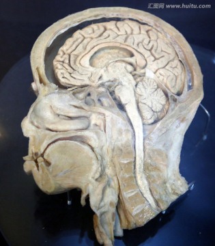 人体脑与延髓标本