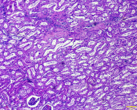 肾脏组织切片 显微摄影 人类器