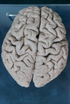 人脑立体图
