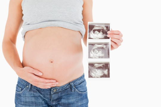 孕妇拿着B超像片