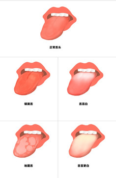 舌苔 舌头症状