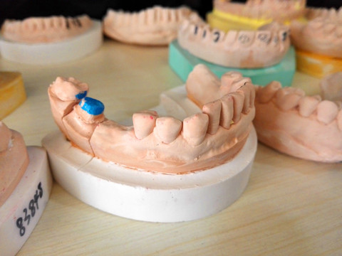 牙齿模型