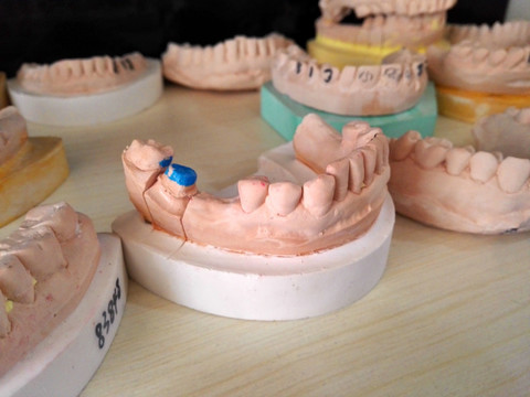 牙齿模型