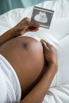 孕妇看超声图片